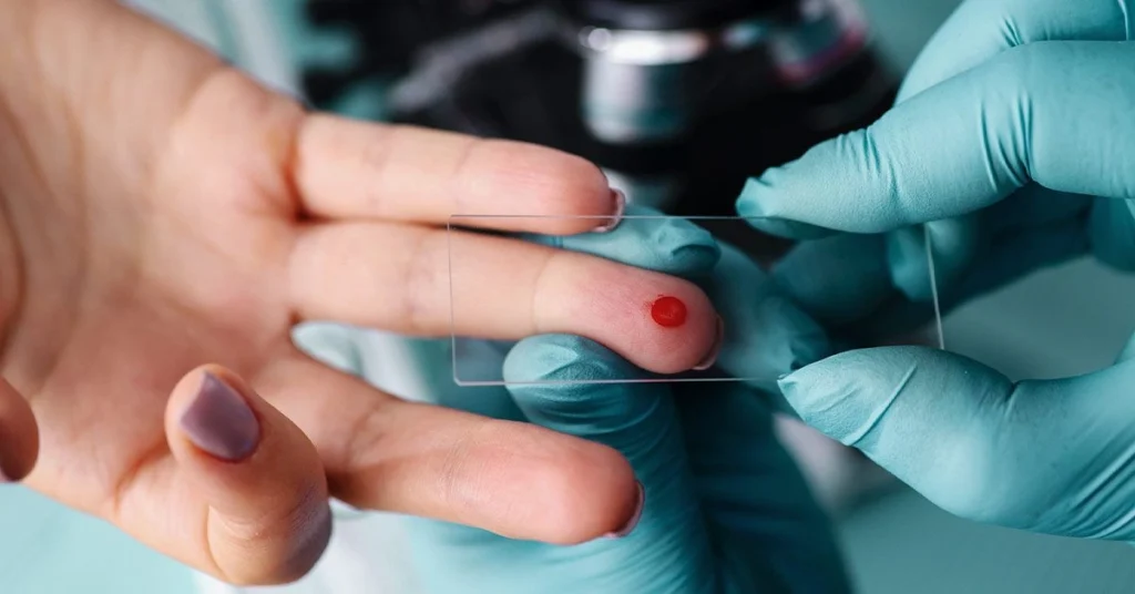 hemoglobin test