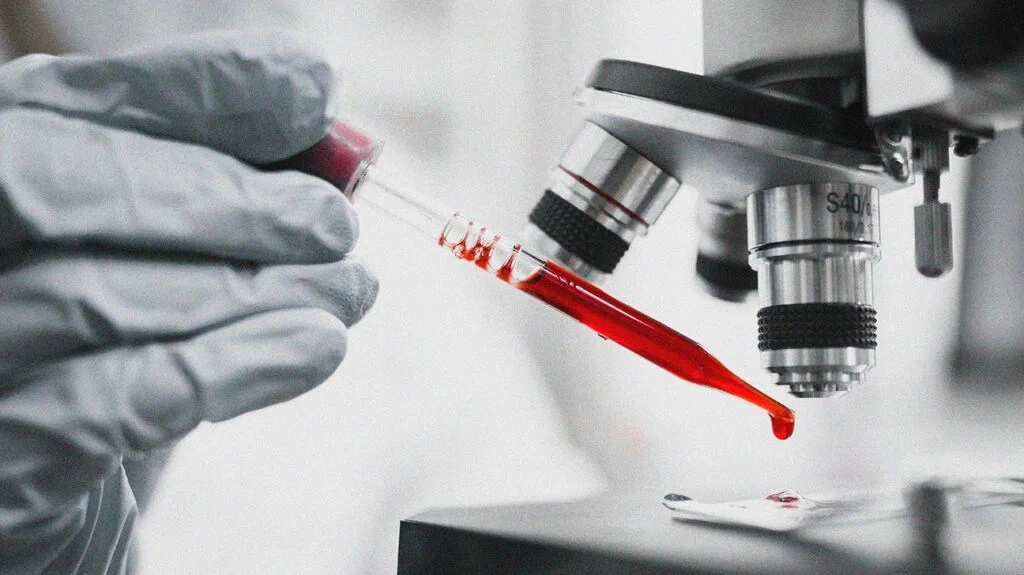 Blood CBC test in Multan