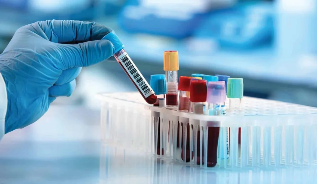 Blood test in Multan