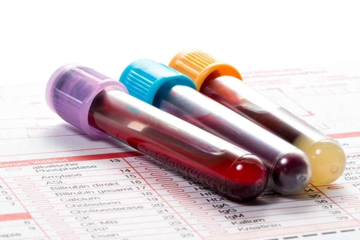 Hemoglobin Test in Multan
