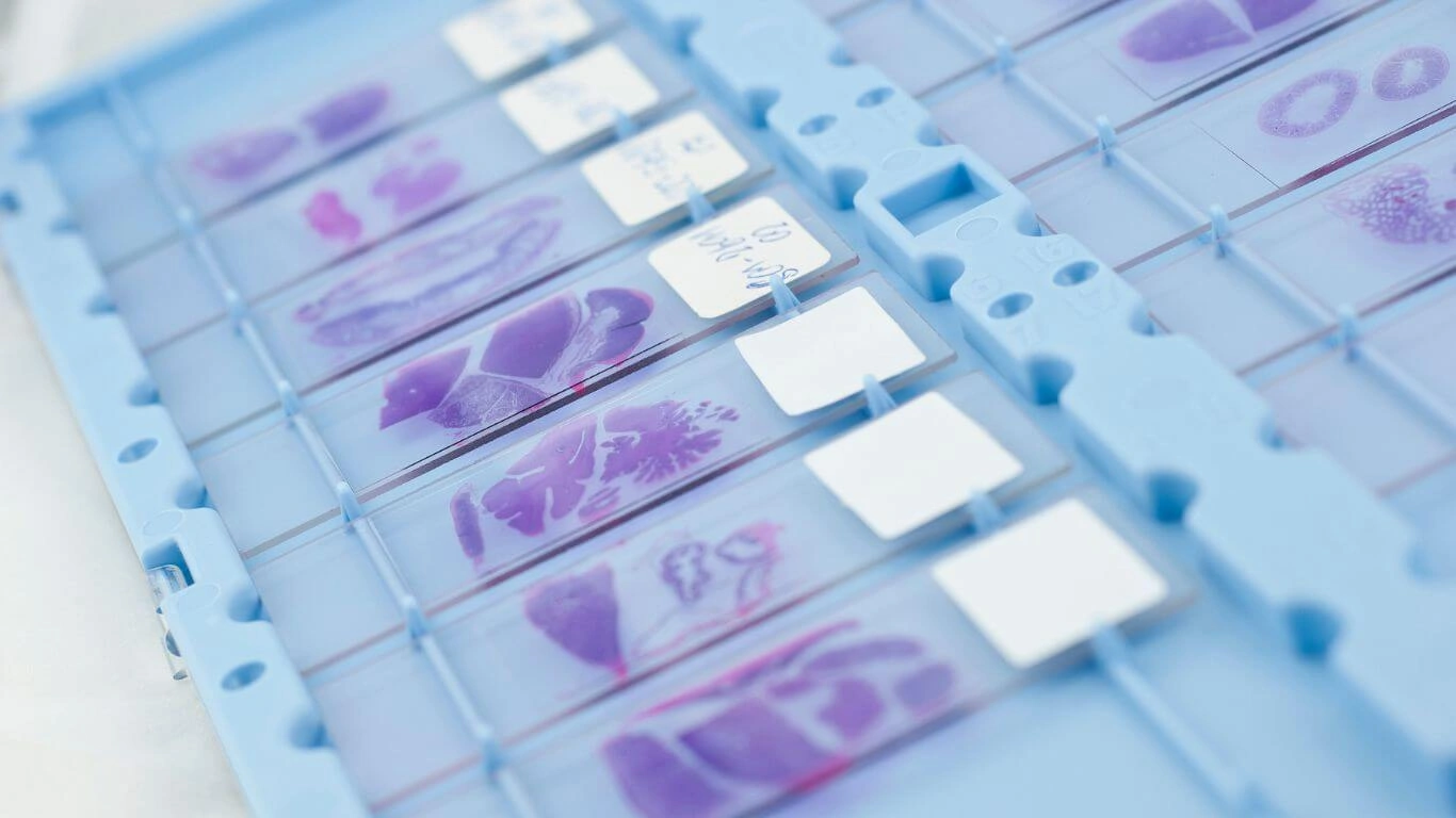 Price Histopathology Lab Test in Multan