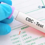 CBC Test at Home in Multan — Complete Guide 2026