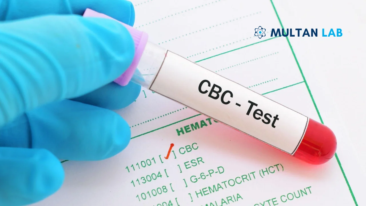 CBC Test at Home in Multan — Complete Guide 2026