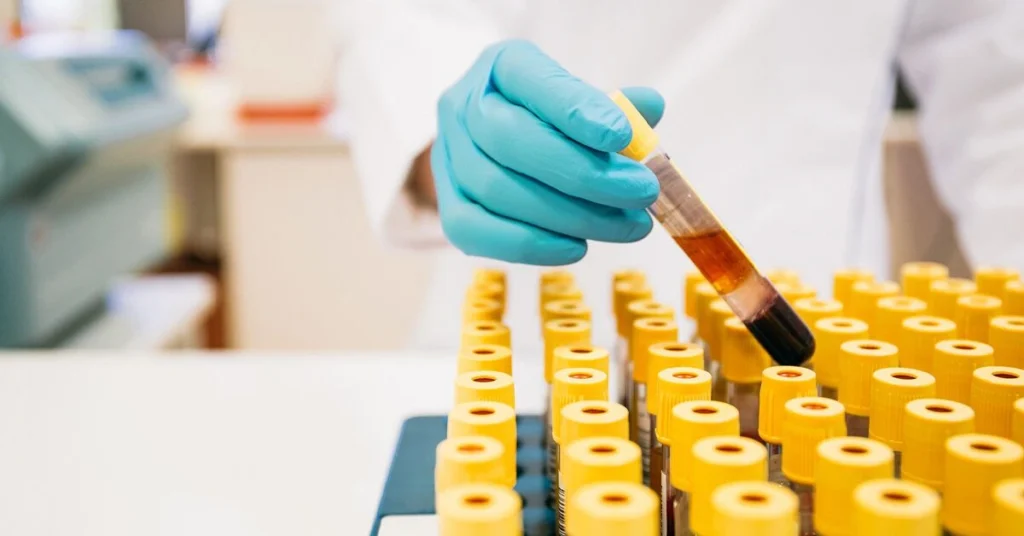 Essential Preventive Lab Tests Every Professional Should Book