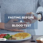 Fasting before blood test